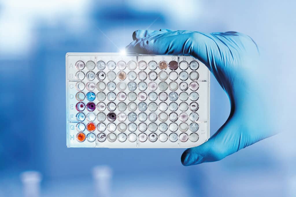 In-vitro veritas. Razendsnelle diagnoses, automatisch foutvrij.